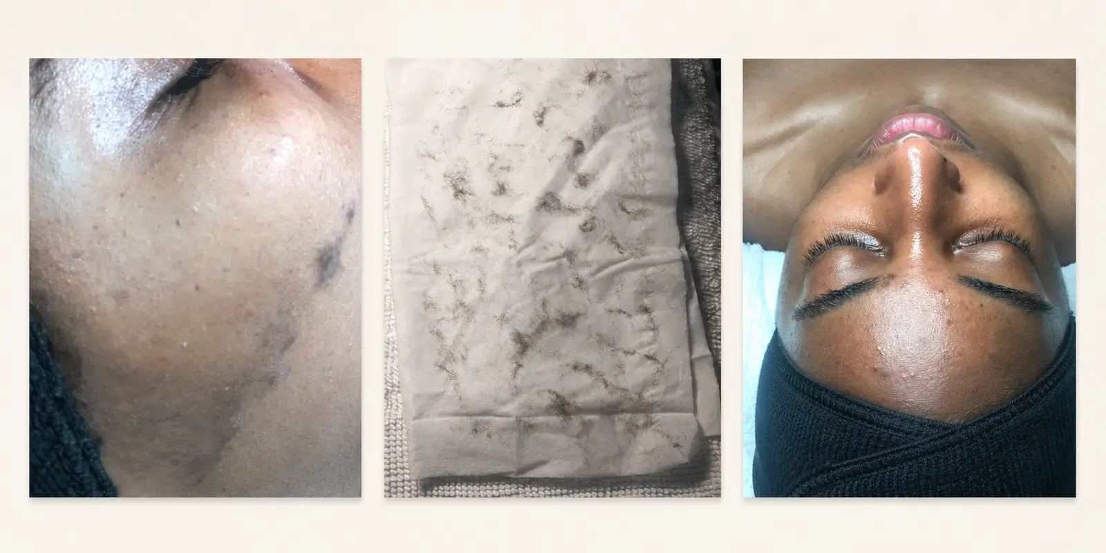 Published Meticulous Spa dermaplaning treatment photographs