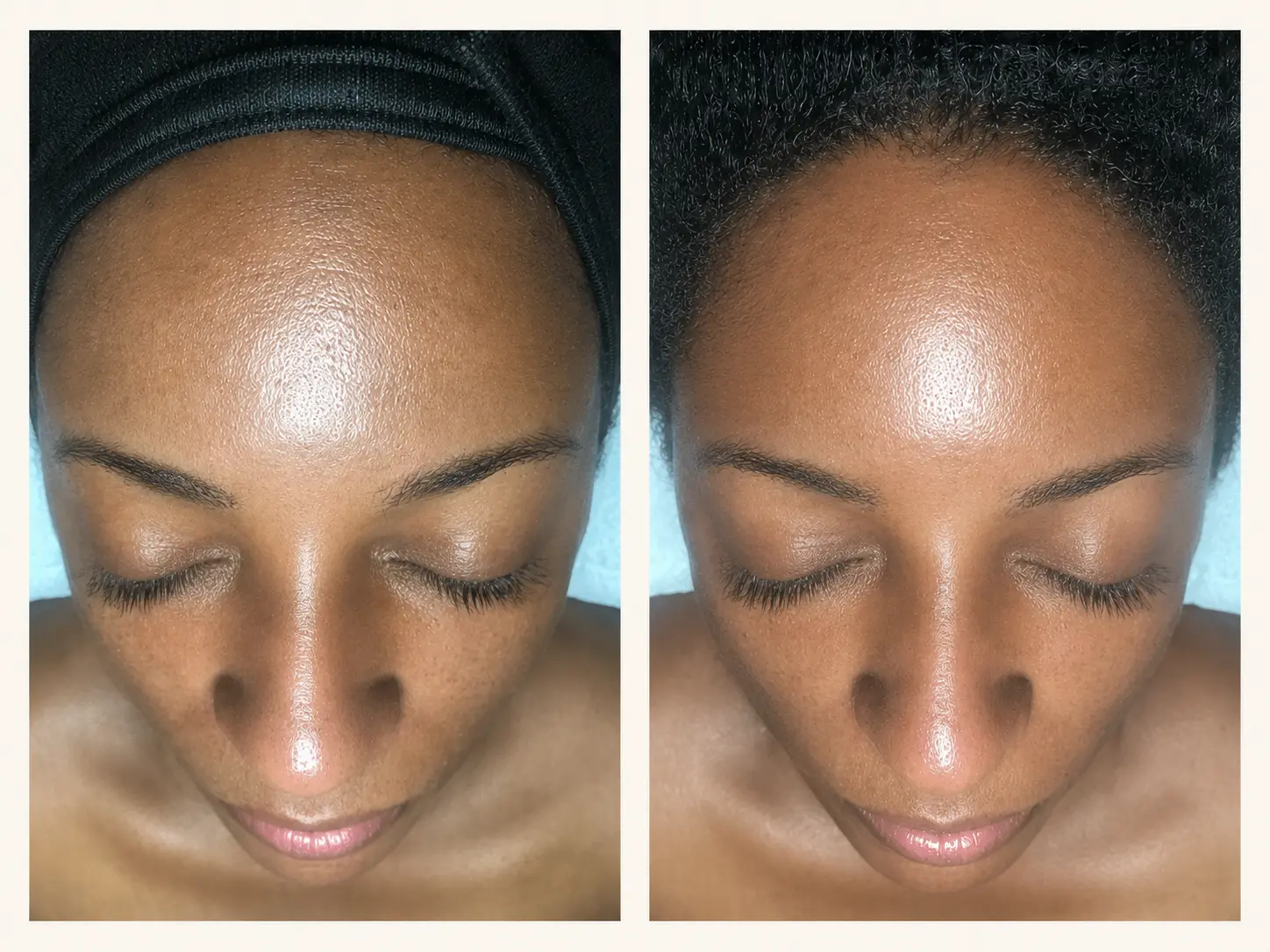 Published Meticulous Spa before-and-after Renew and Rejuvenate facial photographs